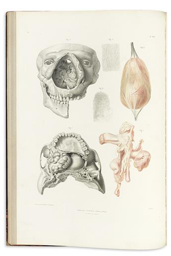 LEBERT, HERMANN. Traité dAnatomie Pathologique Générale et Spéciale.  4 vols. in 6.  1857-61